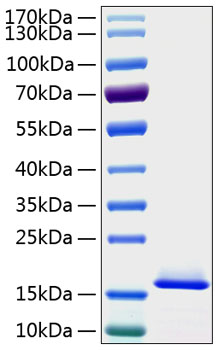 Recombinant Human Cystatin-C/CST3 Protein was determined by SDS-PAGE under reducing conditions with Coomassie Blue.