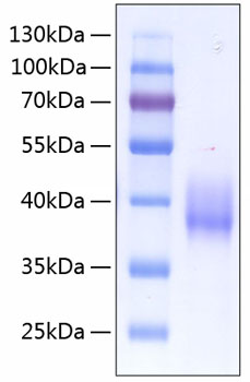 Recombinant Human Coagulation factor III/Tissue factor/CD142 Protein was determined by SDS-PAGE under reducing conditions with Coomassie Blue.