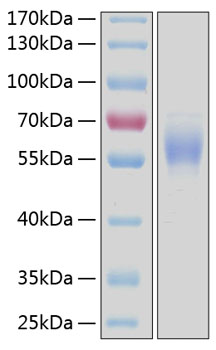 Recombinant Human DDR2/CD167b Protein was determined by SDS-PAGE under reducing conditions with Coomassie Blue.
