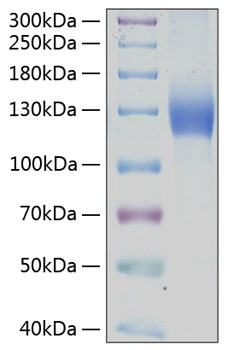 Recombinant Human PDGFR-alpha/CD140a Protein was determined by SDS-PAGE under reducing conditions with Coomassie Blue.