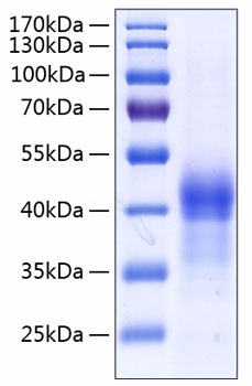 Recombinant Human Lung surfactant protein D/SFTPD(E22G) Protein was determined by SDS-PAGE under reducing conditions with Coomassie Blue.
