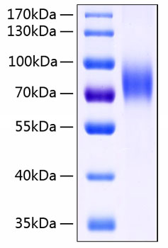 Recombinant Human MIC-B Protein was determined by SDS-PAGE under reducing conditions with Coomassie Blue.