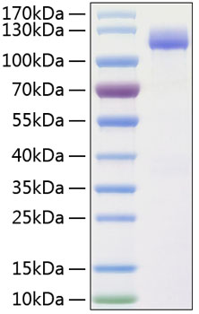 Recombinant Human ALCAM/CD166 Protein was determined by SDS-PAGE under reducing conditions with Coomassie Blue.