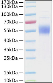 Recombinant Human IL-3RA/CD123 Protein was determined by SDS-PAGE under reducing conditions with Coomassie Blue.