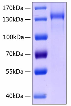 Recombinant Human TIE2/TEK/CD202b Protein was determined by SDS-PAGE under reducing conditions with Coomassie Blue.
