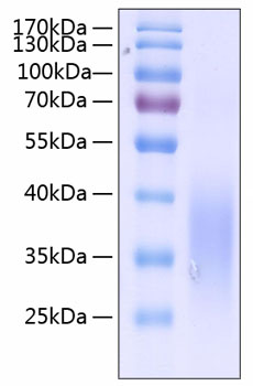 Recombinant Human c-Kit ligand/KITLG/SCF Protein was determined by SDS-PAGE under reducing conditions with Coomassie Blue.