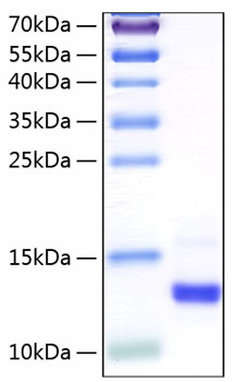 Recombinant Human Colipase/CLPS Protein was determined by SDS-PAGE under reducing conditions with Coomassie Blue.