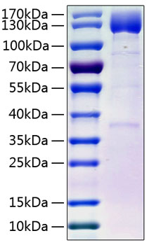Recombinant Human PDGFR-beta/CD140b(E241D) Protein was determined by SDS-PAGE under reducing conditions with Coomassie Blue.