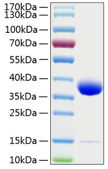 Recombinant Human Prolactin receptor/PRL-R Protein was determined by SDS-PAGE under reducing conditions with Coomassie Blue.