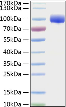 Recombinant Human FGFR-4/CD334 Protein was determined by SDS-PAGE under reducing conditions with Coomassie Blue.