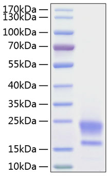 Recombinant Human WAP5/WFDC2/HE4 Protein was determined by SDS-PAGE under reducing conditions with Coomassie Blue.