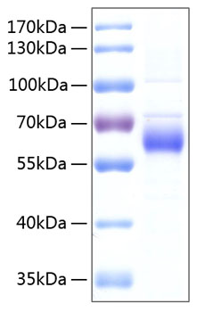 Recombinant Human FGFR-5/FGFRL1 Protein was determined by SDS-PAGE under reducing conditions with Coomassie Blue.