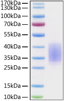 Recombinant Human CD28 Protein was determined by SDS-PAGE under reducing conditions with Coomassie Blue.
