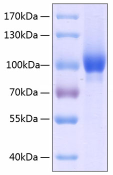 Recombinant Human Neuropilin-1/NRP1/VEGF165R/CD304 Protein was determined by SDS-PAGE under reducing conditions with Coomassie Blue.
