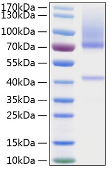 Recombinant Human Glypican-3/GPC3 Protein was determined by SDS-PAGE under reducing conditions with Coomassie Blue.