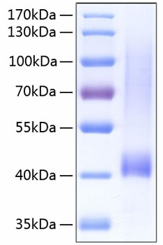 Recombinant Human Biglycan/BGN Protein was determined by SDS-PAGE under reducing conditions with Coomassie Blue.