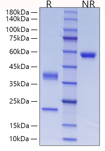 Recombinant Human Complement C1r subcomponent Protein was determined by SDS-PAGE under reducing (R) and non-reducing (NR) conditions.