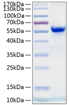 Recombinant Human Ephrin-A4/EFNA4 Protein was determined by SDS-PAGE under reducing conditions with Coomassie Blue.