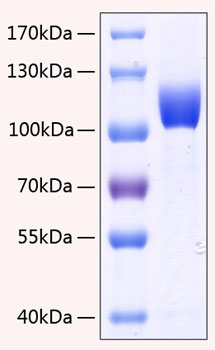 Recombinant Human FGFR-3 alpha (IIIc)/CD333 Protein was determined by SDS-PAGE under reducing conditions with Coomassie Blue.