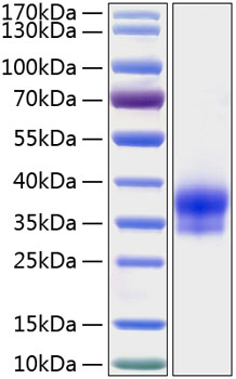 Recombinant Human IGFBP-6 Protein was determined by SDS-PAGE under reducing conditions with Coomassie Blue.