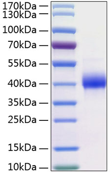 Recombinant Human Kallikrein-11/KLK11 Protein was determined by SDS-PAGE under reducing conditions with Coomassie Blue.