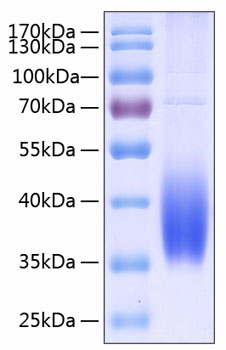 Recombinant Human B7-DC/PD-L2/CD273 Protein was determined by SDS-PAGE under reducing conditions with Coomassie Blue.
