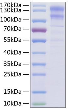 Recombinant Human Low-density lipoprotein receptor/LDLR Protein was determined by SDS-PAGE under reducing conditions with Coomassie Blue.