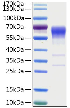 Recombinant Human Activin RIIB/ACVR2B Protein was determined by SDS-PAGE under reducing conditions with Coomassie Blue.