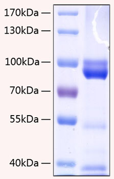Recombinant Human AGER/RAGE Protein was determined by SDS-PAGE under reducing conditions with Coomassie Blue.