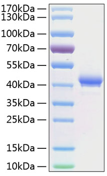 Recombinant Human TNFRSF17/BCMA/CD269 Protein was determined by SDS-PAGE under reducing conditions with Coomassie Blue.