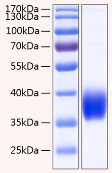 Recombinant Human Carbonic anhydrase 12 Protein was determined by SDS-PAGE under reducing conditions with Coomassie Blue.