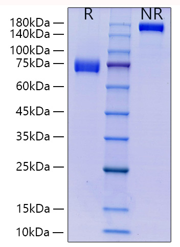 Recombinant Human Siglec-3/CD33 Protein was determined by SDS-PAGE under reducing (R) and non-reducing (NR) conditions.