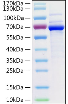 Recombinant Human5'-Nucleotidase/NT5E/CD73 Protein was determined by SDS-PAGE under reducing conditions with Coomassie Blue.