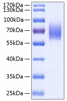 Recombinant Human IL-18BP Protein was determined by SDS-PAGE under reducing conditions with Coomassie Blue.