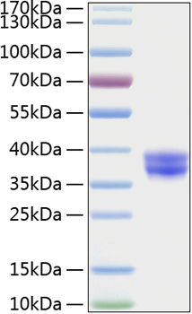 Recombinant Human Cell surface A33 antigen/GPA33 Protein was determined by SDS-PAGE under reducing conditions with Coomassie Blue.