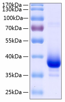 Recombinant Human TNFRSF12A/TWEAKR/CD266 Protein was determined by SDS-PAGE under reducing conditions with Coomassie Blue.