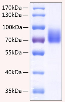 Recombinant Human SLAMF4/2B4/CD244 Protein was determined by SDS-PAGE under reducing conditions with Coomassie Blue.