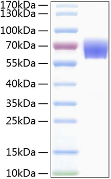 Recombinant Human TREM-1/CD354 Protein was determined by SDS-PAGE under reducing conditions with Coomassie Blue.
