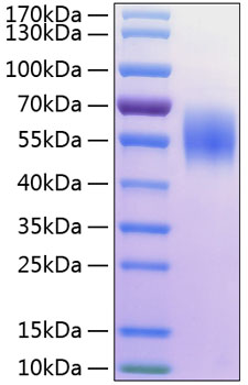 Recombinant Human MHC class I polypeptide-related sequence A/MIC-A Protein was determined by SDS-PAGE under reducing conditions with Coomassie Blue.