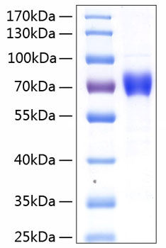 Recombinant Human IL-12A/IL-12 p35 Protein was determined by SDS-PAGE under reducing conditions with Coomassie Blue.