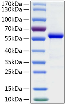 Recombinant Human Ephrin-A5/EFNA5 Protein was determined by SDS-PAGE under reducing conditions with Coomassie Blue.