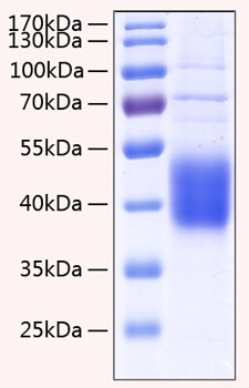 Recombinant Human IL-21R/CD360 Protein was determined by SDS-PAGE under reducing conditions with Coomassie Blue.