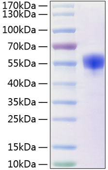 Recombinant Human NKp30/NCR3/CD337 Protein was determined by SDS-PAGE under reducing conditions with Coomassie Blue.