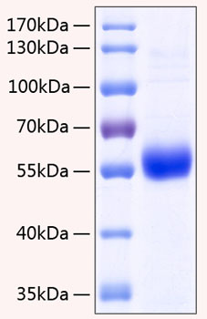 Recombinant Human TNFRSF11B/Osteoprotegerin Protein was determined by SDS-PAGE under reducing conditions with Coomassie Blue.
