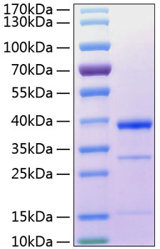 Recombinant Human Cathepsin S Protein was determined by SDS-PAGE under reducing conditions with Coomassie Blue.
