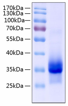 Recombinant Human IGFBP-4 Protein was determined by SDS-PAGE under reducing conditions with Coomassie Blue.