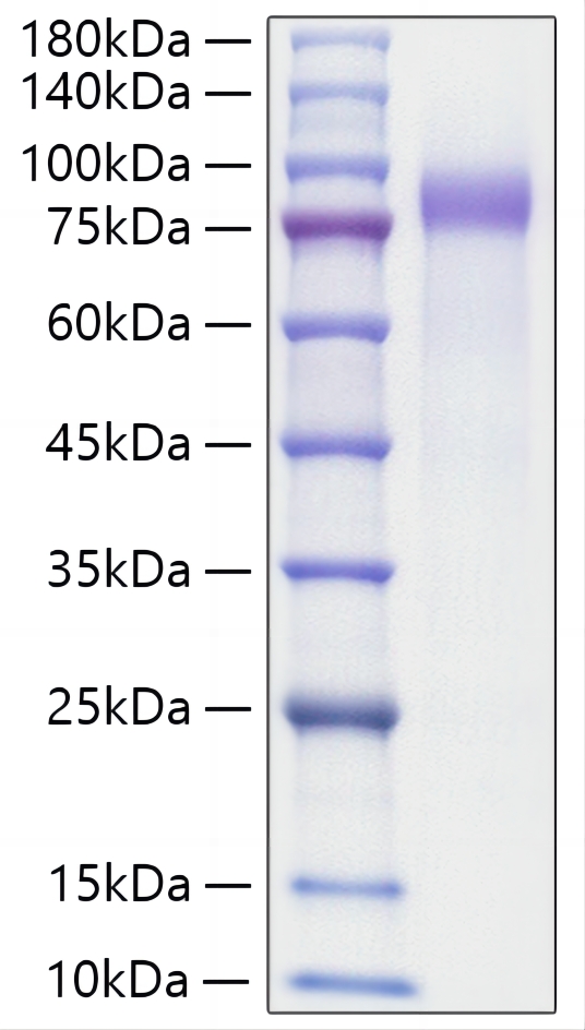 Recombinant Human Progranulin/PGRN/GRN Protein was determined by SDS-PAGE under reducing conditions with Coomassie Blue.