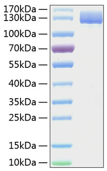 Recombinant Human Aminopeptidase N/APN/CD13 Protein was determined by SDS-PAGE under reducing conditions with Coomassie Blue.