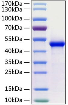 Recombinant Human WIF-1(Q166K) Protein was determined by SDS-PAGE under reducing conditions with Coomassie Blue.
