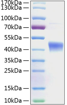 Recombinant Human IL-22RA2/IL22BP Protein was determined by SDS-PAGE under reducing conditions with Coomassie Blue.